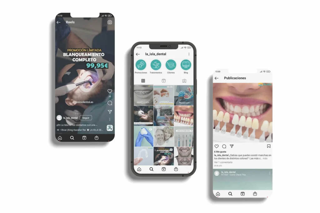 imagen destacada isla dental